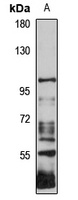 NIK Rabbit Polyclonal Antibody