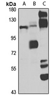 MEKKK5 Rabbit Polyclonal Antibody