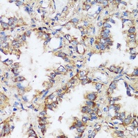 Anti-ERK1/2 Antibody