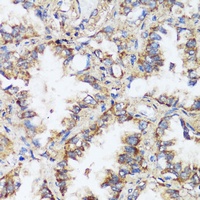 ERK1/2 antibody