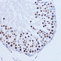 Matrin 3 Rabbit Polyclonal Antibody