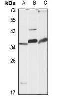 MC1 Receptor Rabbit Polyclonal Antibody