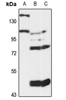MCC Rabbit Polyclonal Antibody
