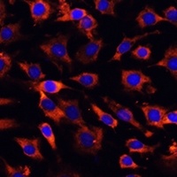 Anti-MCTS1 Antibody