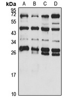 MEAF6 Rabbit Polyclonal Antibody