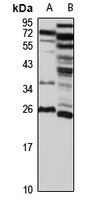 MED19 Rabbit Polyclonal Antibody