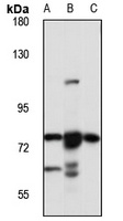 MED25 Rabbit Polyclonal Antibody