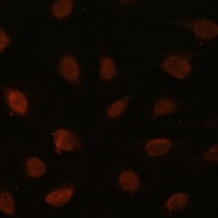 Anti-MED25 Antibody