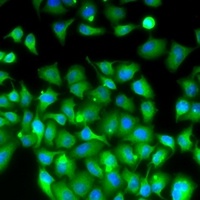 MOX-1 Rabbit Polyclonal Antibody