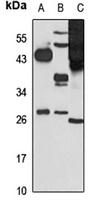 MESP1 Rabbit Polyclonal Antibody