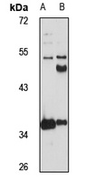 METTL1 Antibody