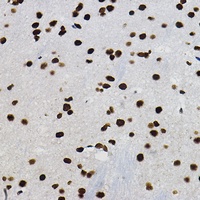 Anti-METTL14 Antibody