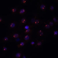 METTL16 antibody