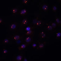 Anti-METTL16 Antibody
