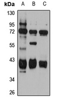 METTL2B Antibody