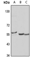 METTL4 Rabbit Polyclonal Antibody