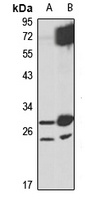 METTL7B Antibody