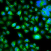 Anti-METTL7B Antibody