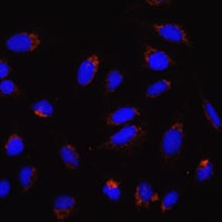 Anti-MFN2 Antibody