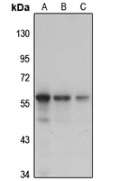 GnT-IVa Rabbit Polyclonal Antibody
