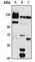 NCOAT Rabbit Polyclonal Antibody