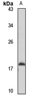 MGST1 Rabbit Polyclonal Antibody
