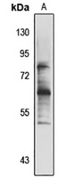 BBS6 Rabbit Polyclonal Antibody