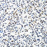 Anti-MKL1 Antibody