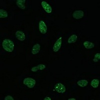 Anti-MKL1 Antibody