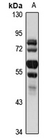 Makorin-3 Rabbit Polyclonal Antibody