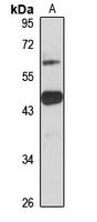MLC1 Rabbit Polyclonal Antibody