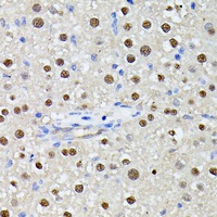 Anti-MLF2 Antibody