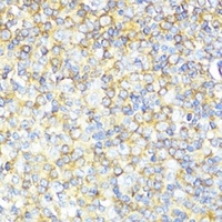 MLKL antibody