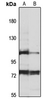 MLLT10 Rabbit Polyclonal Antibody