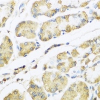 Anti-Motilin Antibody