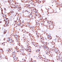 MRPL23 antibody