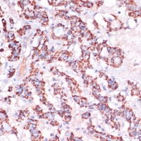 Anti-MRPL23 Antibody