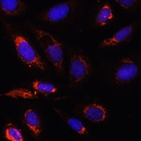 Anti-MRPL23 Antibody