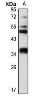 MRPL44 Rabbit Polyclonal Antibody