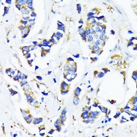 MRPL45 Antibody