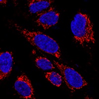 Anti-MRPS31 Antibody