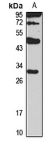 MS4A12 Rabbit Polyclonal Antibody