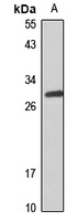 MS4A2 Rabbit Polyclonal Antibody