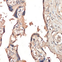 HGFL Rabbit Polyclonal Antibody