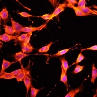 HGFL Rabbit Polyclonal Antibody