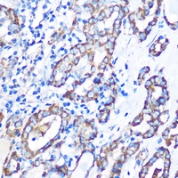 Anti-MST4 Antibody