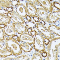 Anti-COX3 Antibody