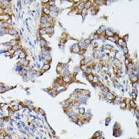 Anti-MTIF2 Antibody