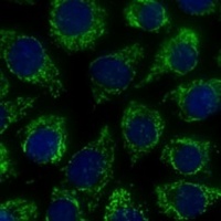 Anti-MTIF2 Antibody