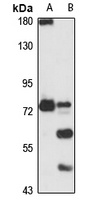 MTMR1 Rabbit Polyclonal Antibody